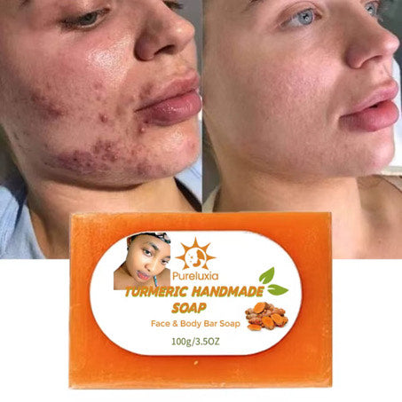 Clean and Bright Turmeric Soap